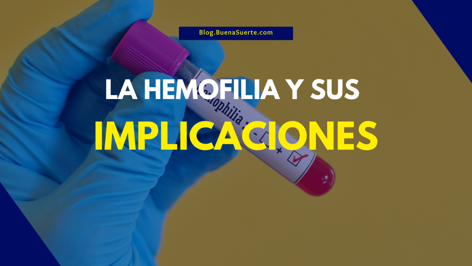 Qué Es La Hemofilia Y Sus Implicaciones - Nuestro Blog